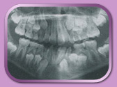 panoramic x-ray